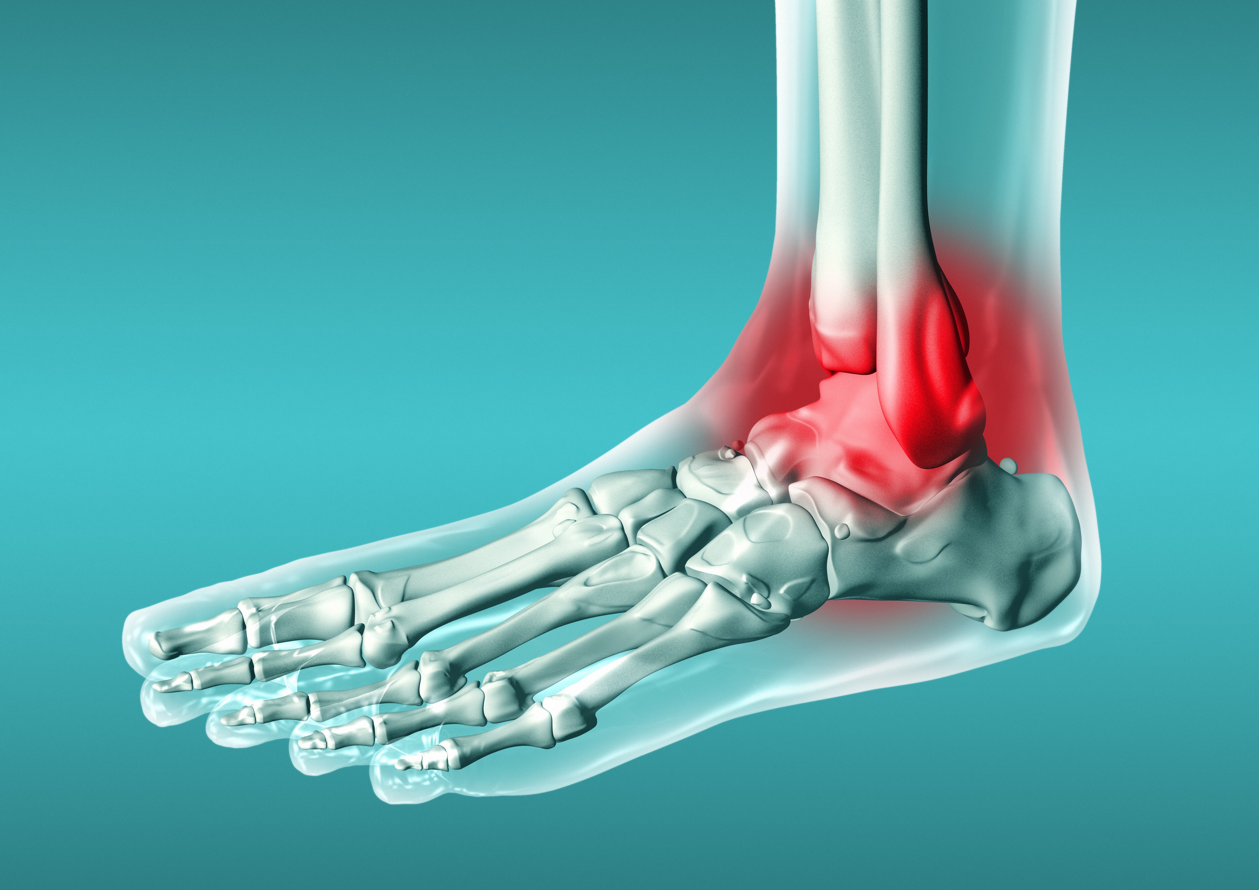 El ejercicio también es uno de los factores que puede ayudar a reducir la inflamación y el dolor en las articulaciones.