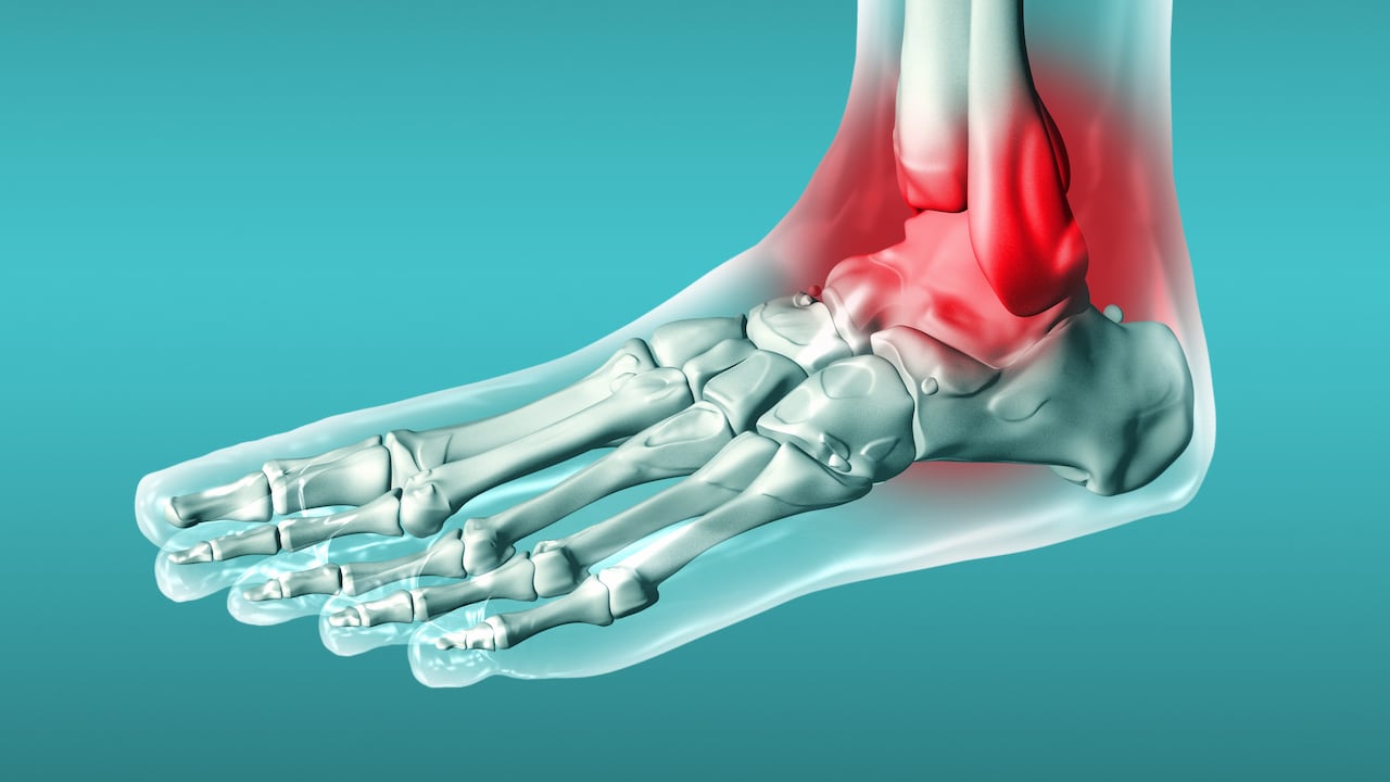 El ejercicio también es uno de los factores que puede ayudar a reducir la inflamación y el dolor en las articulaciones.