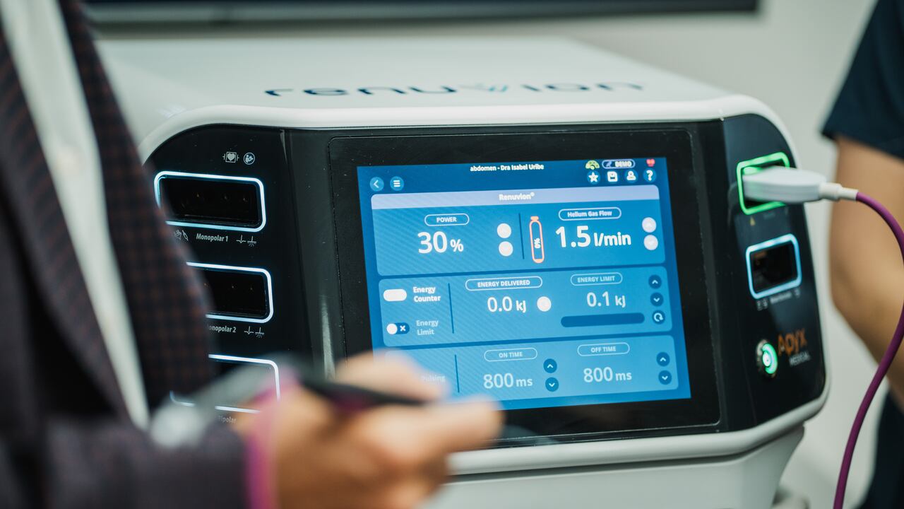 Renuvion Apyx One con la pieza de mano Micro representa una nueva etapa en la cirugía estética: ahora la precisión reemplaza al trauma, la recuperación es más corta y la piel encuentra, literalmente, una segunda oportunidad de adherirse al cuerpo.