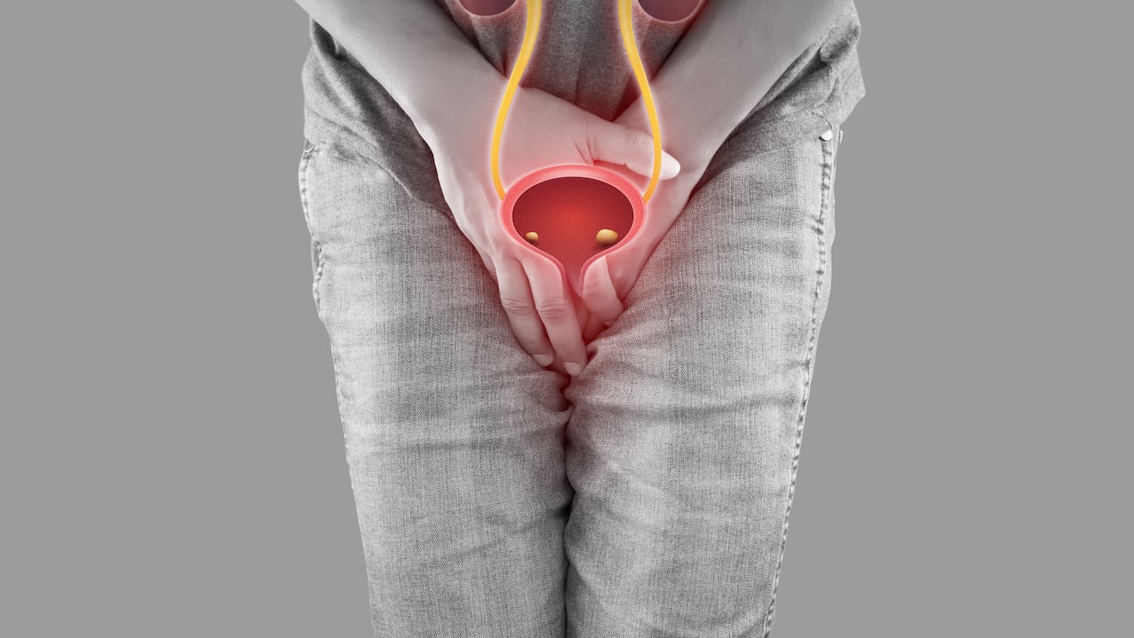 Infección Urinaria- presencia de dolor