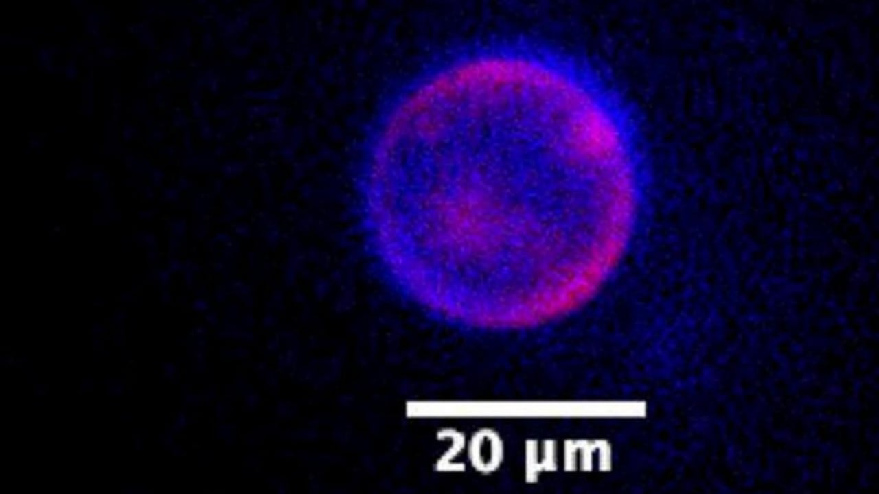 Imagen de SpudCell encapsulando su genoma completo, con el ADN y la membrana sintética marcados con tintes fluorescentes.