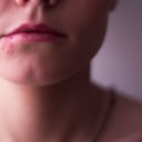 Herpes labial