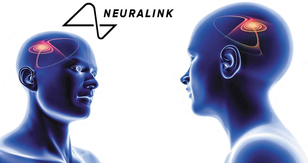 El chip cerebral revolucionario.