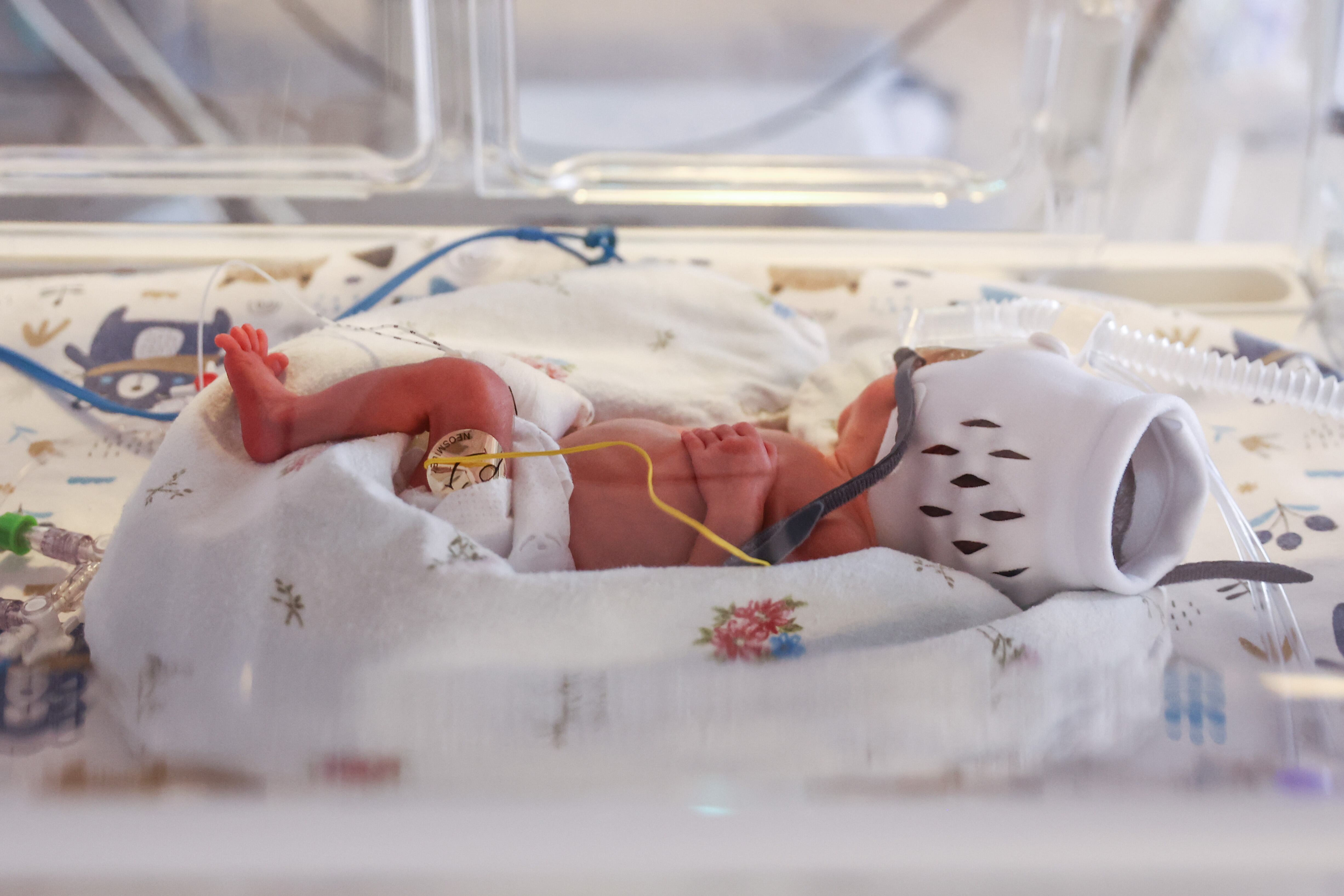 Un bebé se ve en una incubadora.