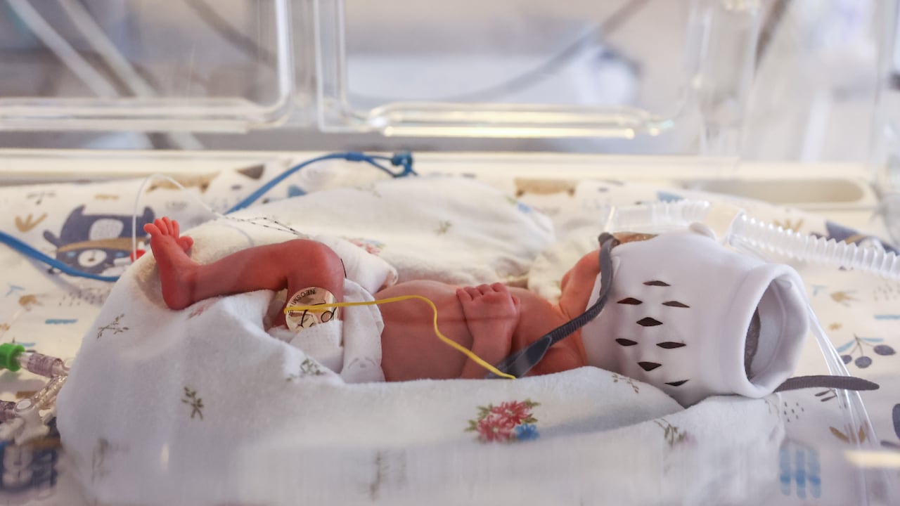 Una bebé de 4 meses resultó herida por una bala en Medellín.