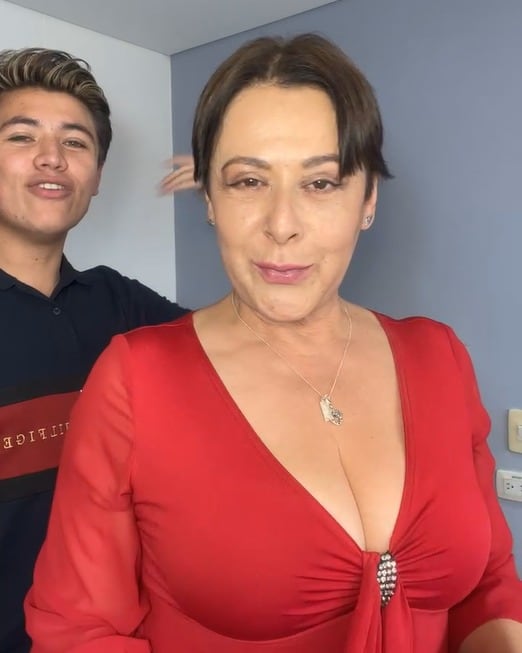 La mujer se quitó las gafas oscuras que traía y reveló el avance que tiene su rostro tras la cirugía.