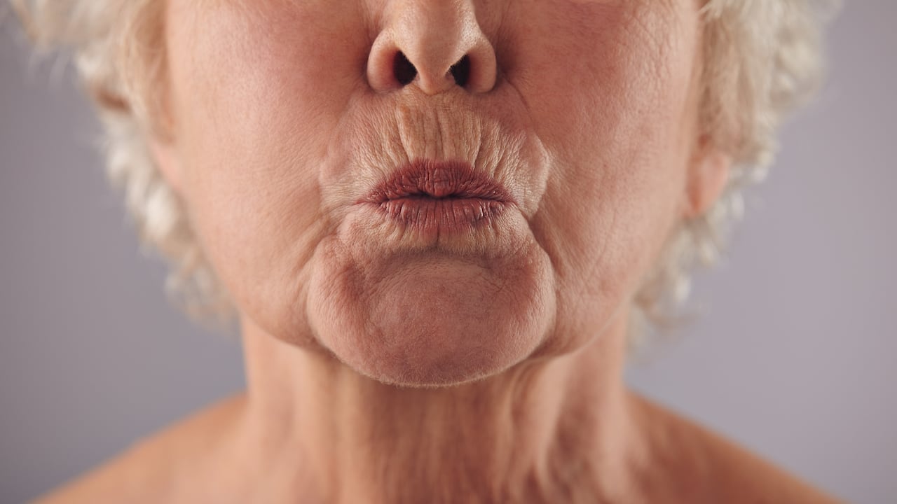 Muchos tratamientos en la actualidad buscan rellenar e hidratar los labios.
