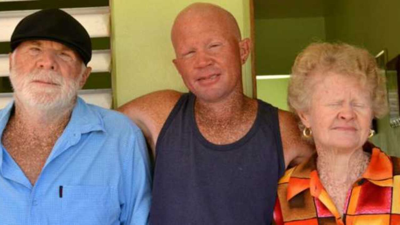 Miguel el padre, Alejandro uno de los hijos y Rita posan para la cámara. Todos en la familia Nieves Nieves son albinos.