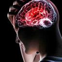 La parálisis Cerebral incluye un grupo de condiciones permanentes y no progresivas que comprometen la movilidad.