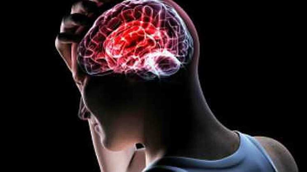 La parálisis Cerebral incluye un grupo de condiciones permanentes y no progresivas que comprometen la movilidad.