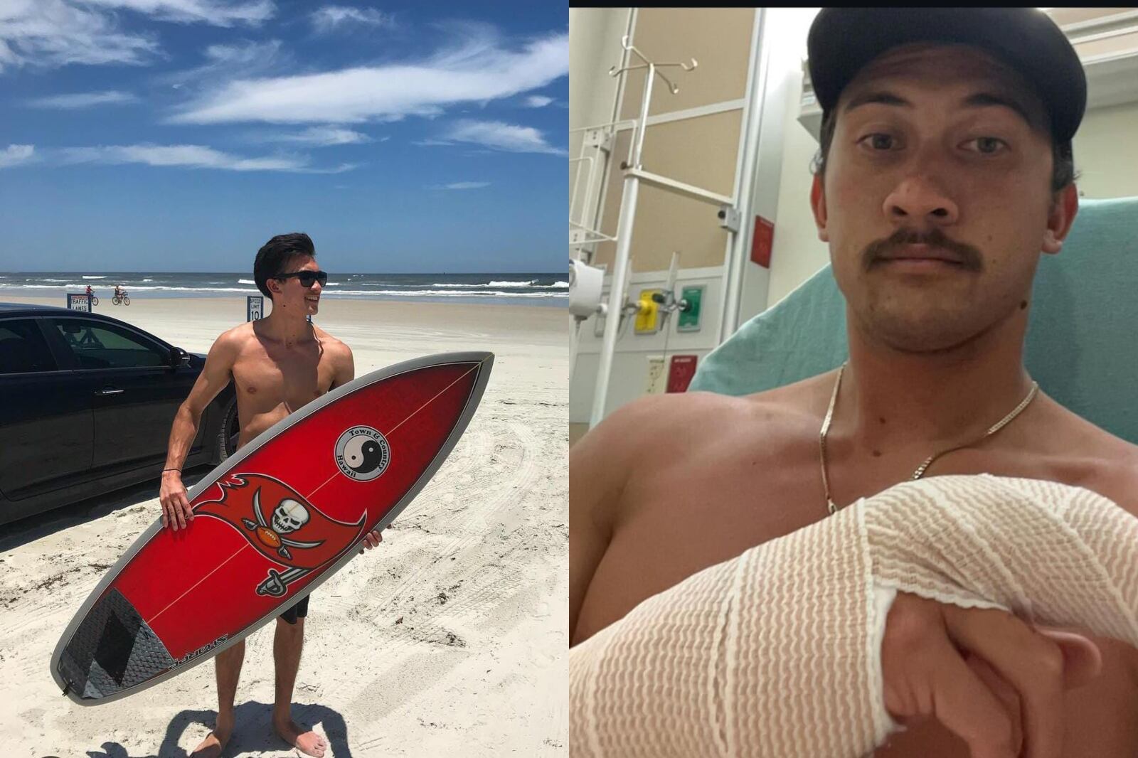 Cjlyles es atacado en las costas de Estados Unidos por un tiburón