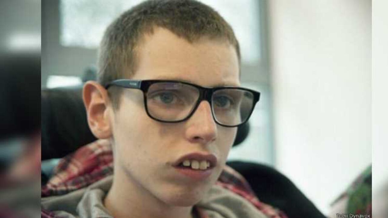 Adquirir un Eye Gaze cuesta unos US$15.000.