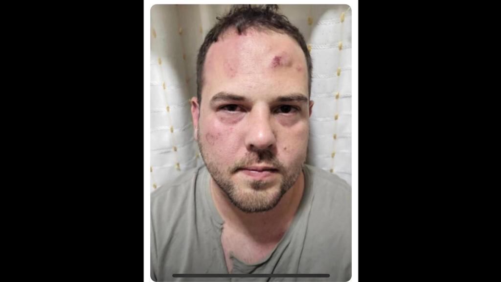 John Poulos, el presunto asesino de la DJ Valentina Trespalacios, habría sido golpeado en la cárcel.