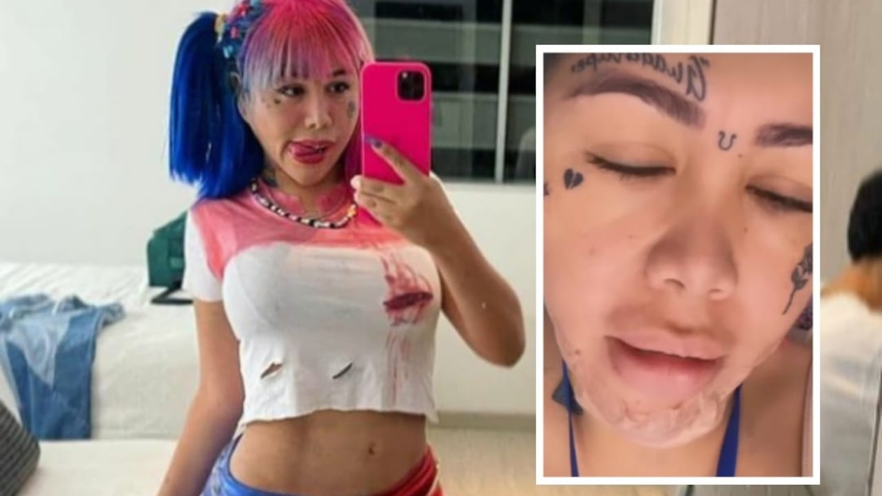 La mujer se sometió a varias cirugías para ser la próxima 'Barbie colombiana'.