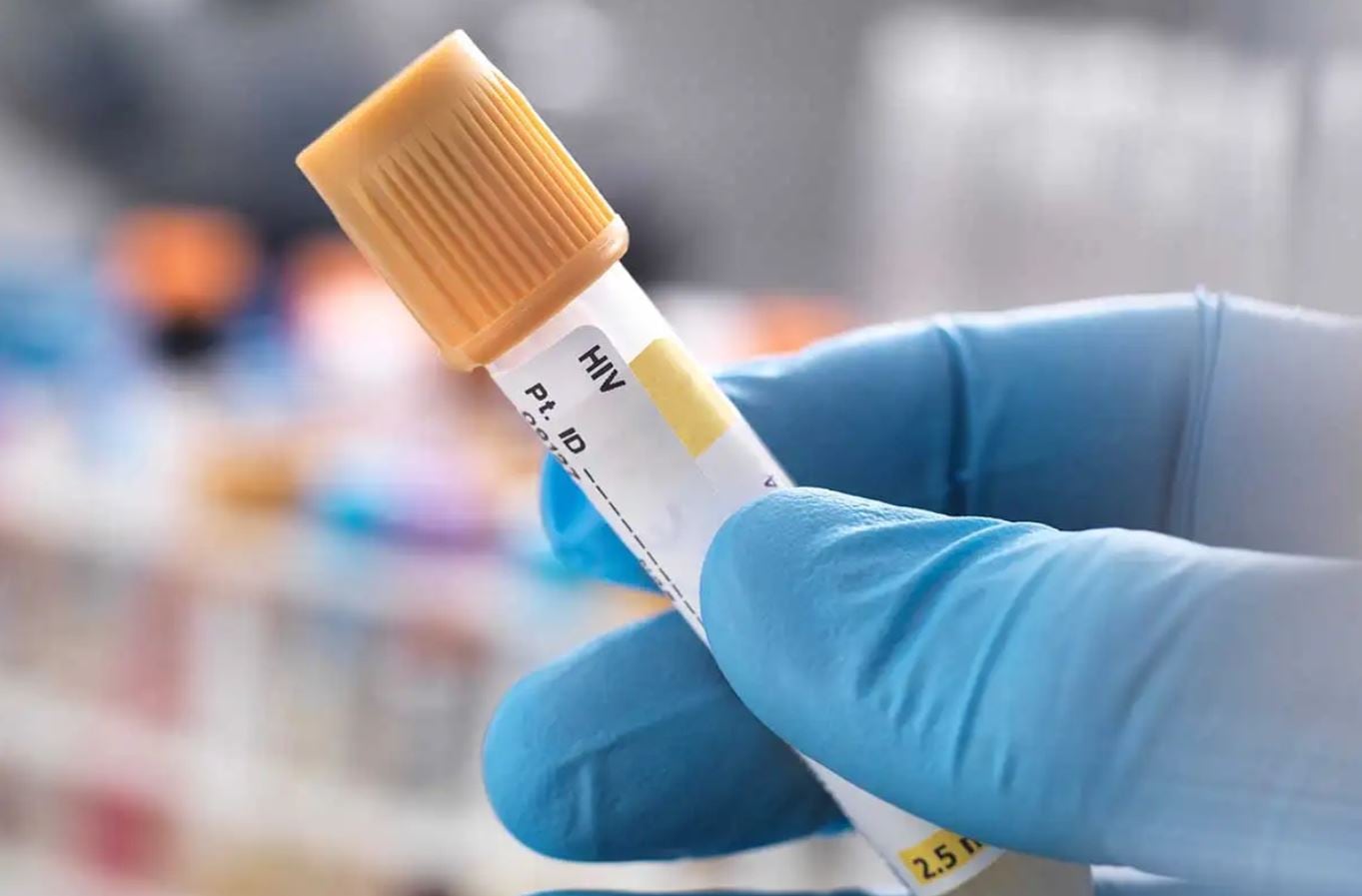 Gracias al rol que desempeña el sector salud es posible encontrar actualmente diferentes alternativas que permiten tener mayor conocimiento sobre la incidencia de estas ETS.