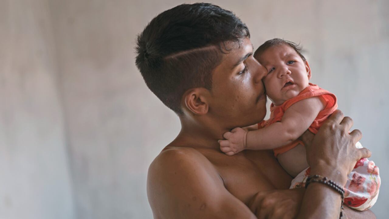 Además de la malformación en el cráneo, hay otros síntomas asociados con la microcefalia como problemas de peso, convulsiones, llanto agudo constante y retrasos en el desarrollo psicomotriz.