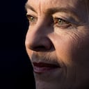 Las arrugas en el contorno de los labios son frecuentes con el paso de los años.