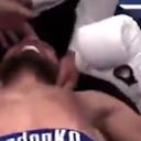 Los primeros informes indicaron que el ruso tuvo que ser examinado por un neurólogo al presentar una convulsión tónico-clónica causada por el golpe de iglesias y que podría dejarle secuelas. Foto: @nuevodiarioweb