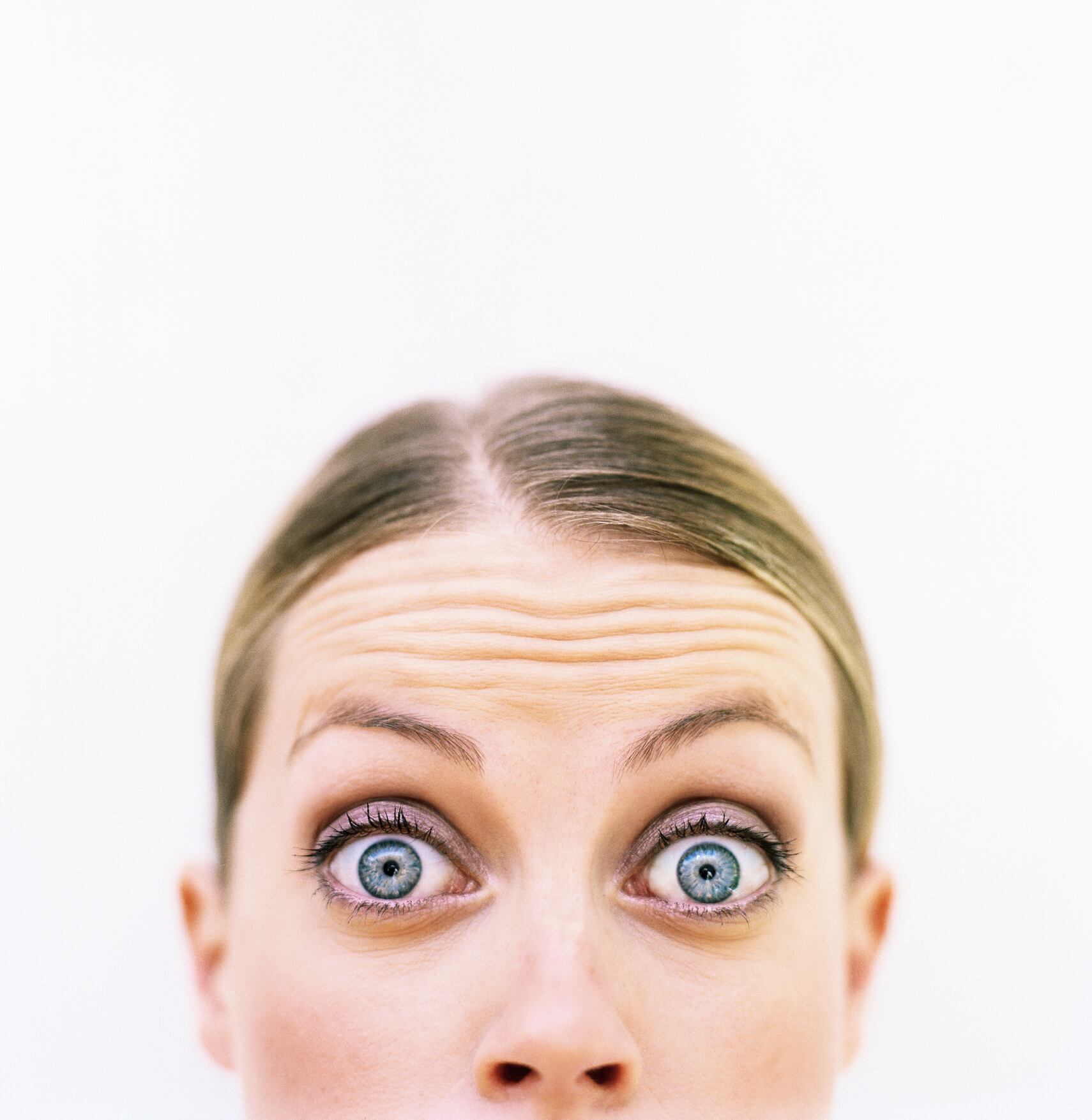 Arrugas en la frente