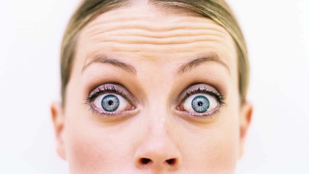 Las arrugas son las líneas de expresión que aparecen con mayor frecuencia.