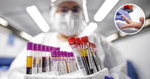 Personal médico en Bogotá está en alerta por el aumento de casos, prevalencia e incidencia de sífilis gestacional y congénita en la ciudad.