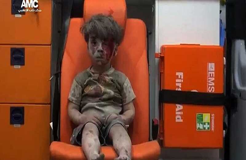 Omran Daqneesh, el niño que sobrevivió a un ataque aéreo y se convirtió en símbolo del horror. 18 de agosto del 2016. Foto: AFP.