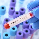 El raquitismo en ocasiones se presenta a raíz de la falta de vitamina D.