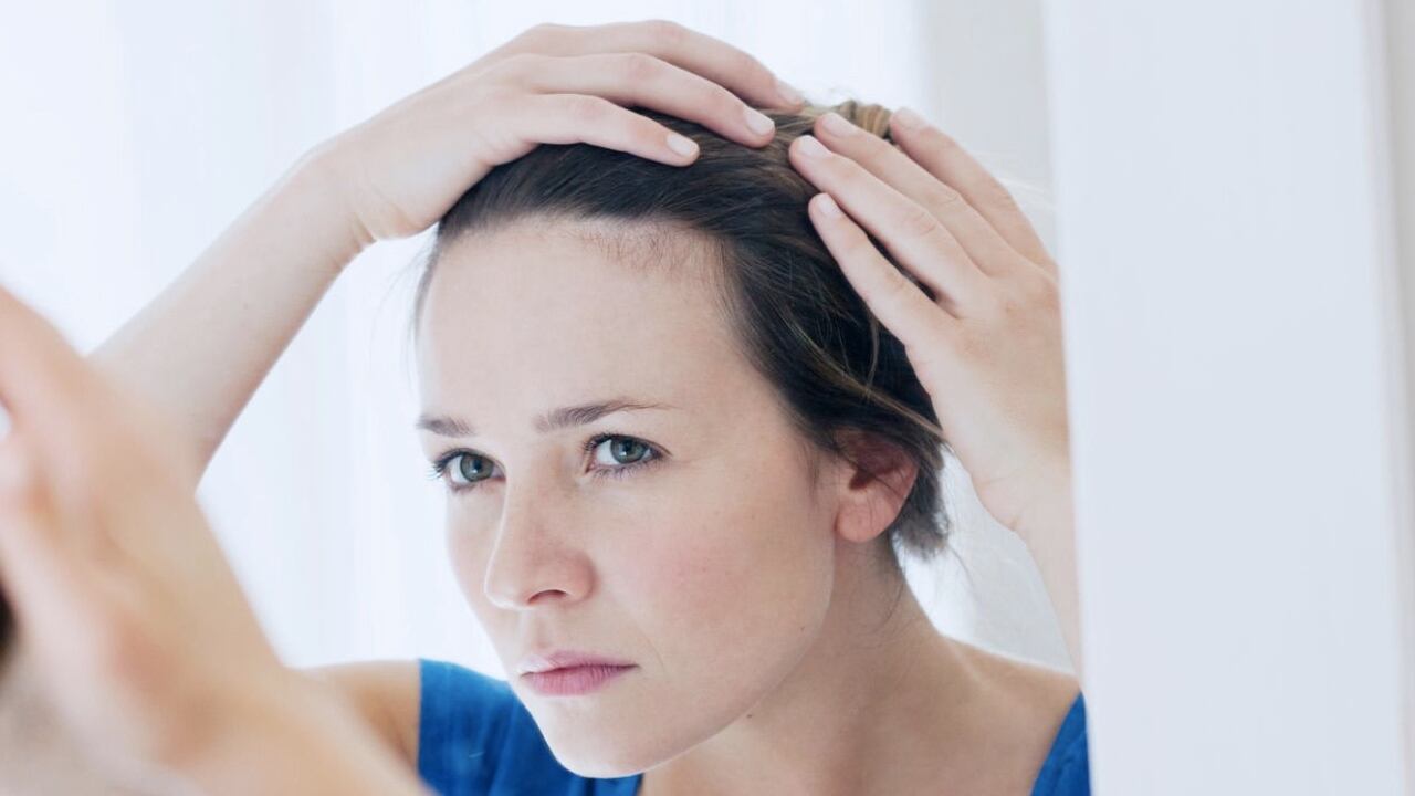 La caspa es un problema que la mayoría de personas han experimentado en algún momento de su vida.