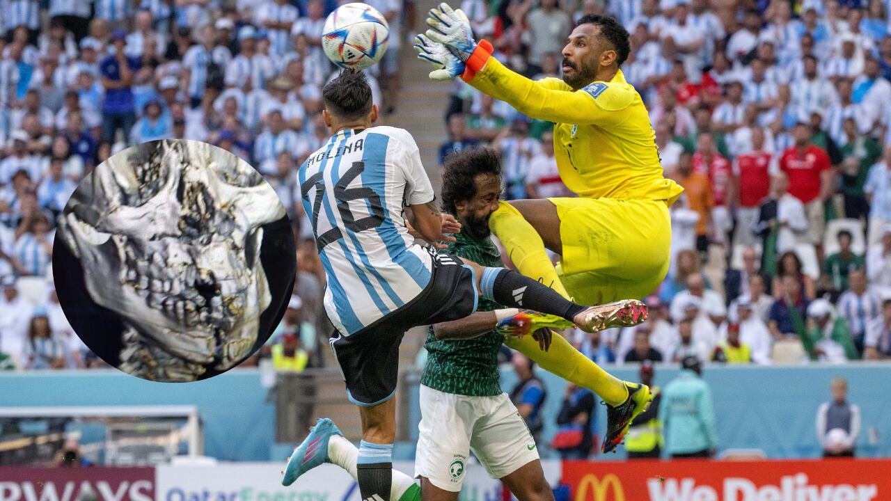Estruendoso choque en el Argentina vs. Arabia Saudita.