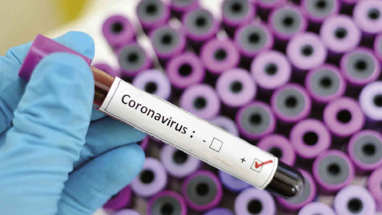 En Rusia han fallecido cuatro personas por la pandemia/Foto: archivo SEMANA