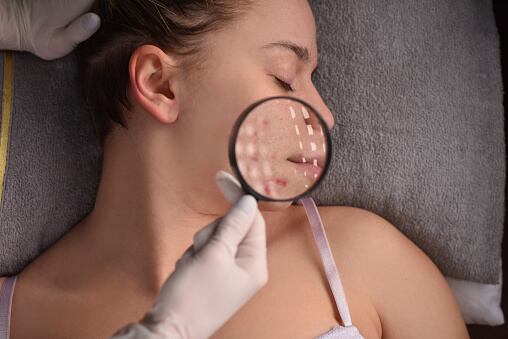 envejecimiento prematuro