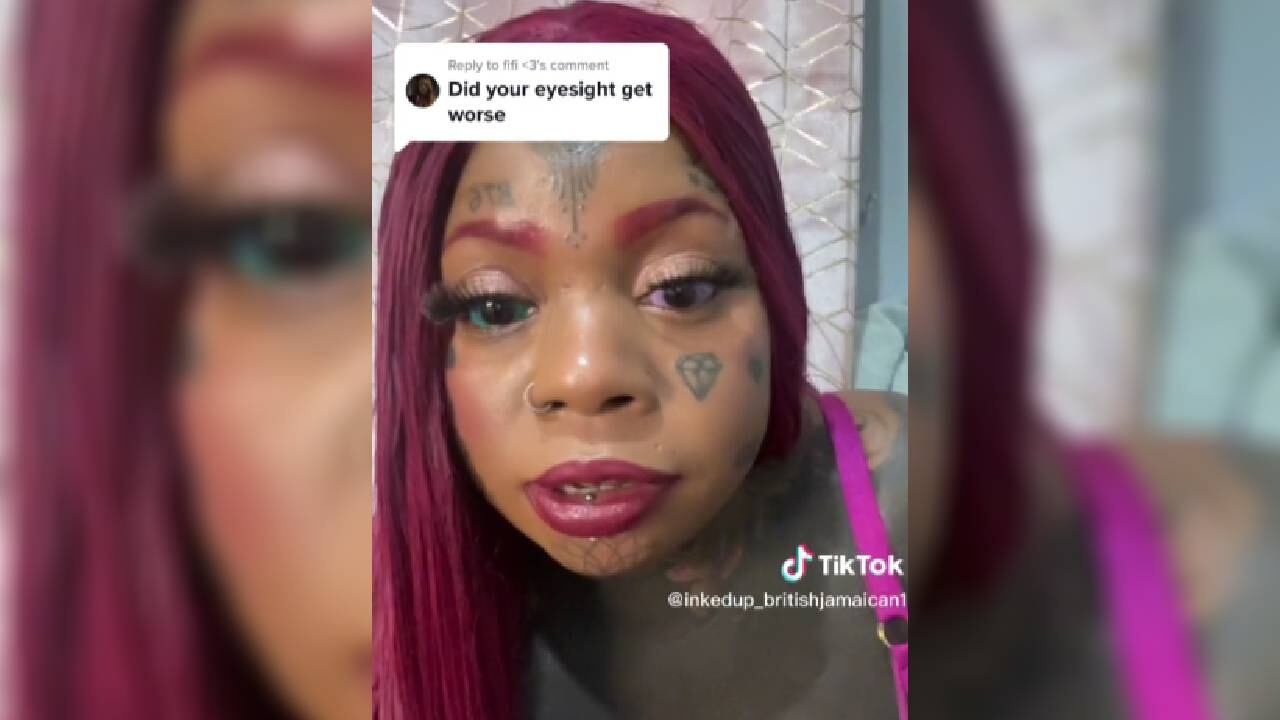 Mujer dice estar arrepentida por tatuarse los ojos.