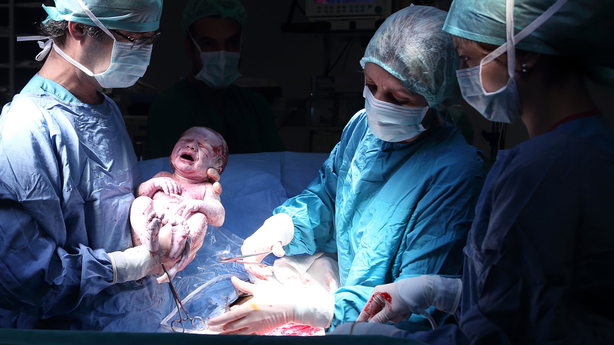 Embarazo parto nacimiento bebé