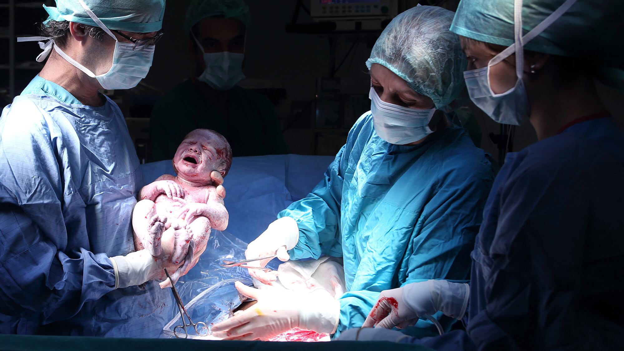 Embarazo parto nacimiento bebé