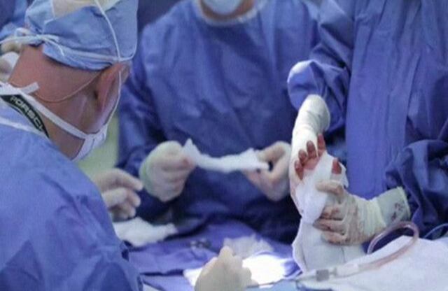 Los médicos unieron arterias, venas, músculos, tendones y nervios. 