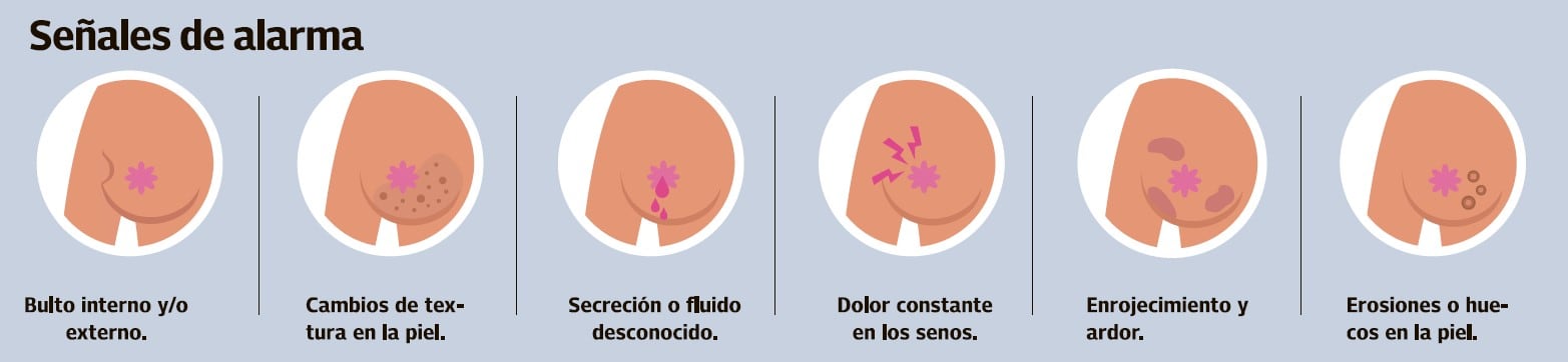 Tenga en cuenta estas señales en el momento del autoexamen o en el día a día, pueden significar que algo no está bien.