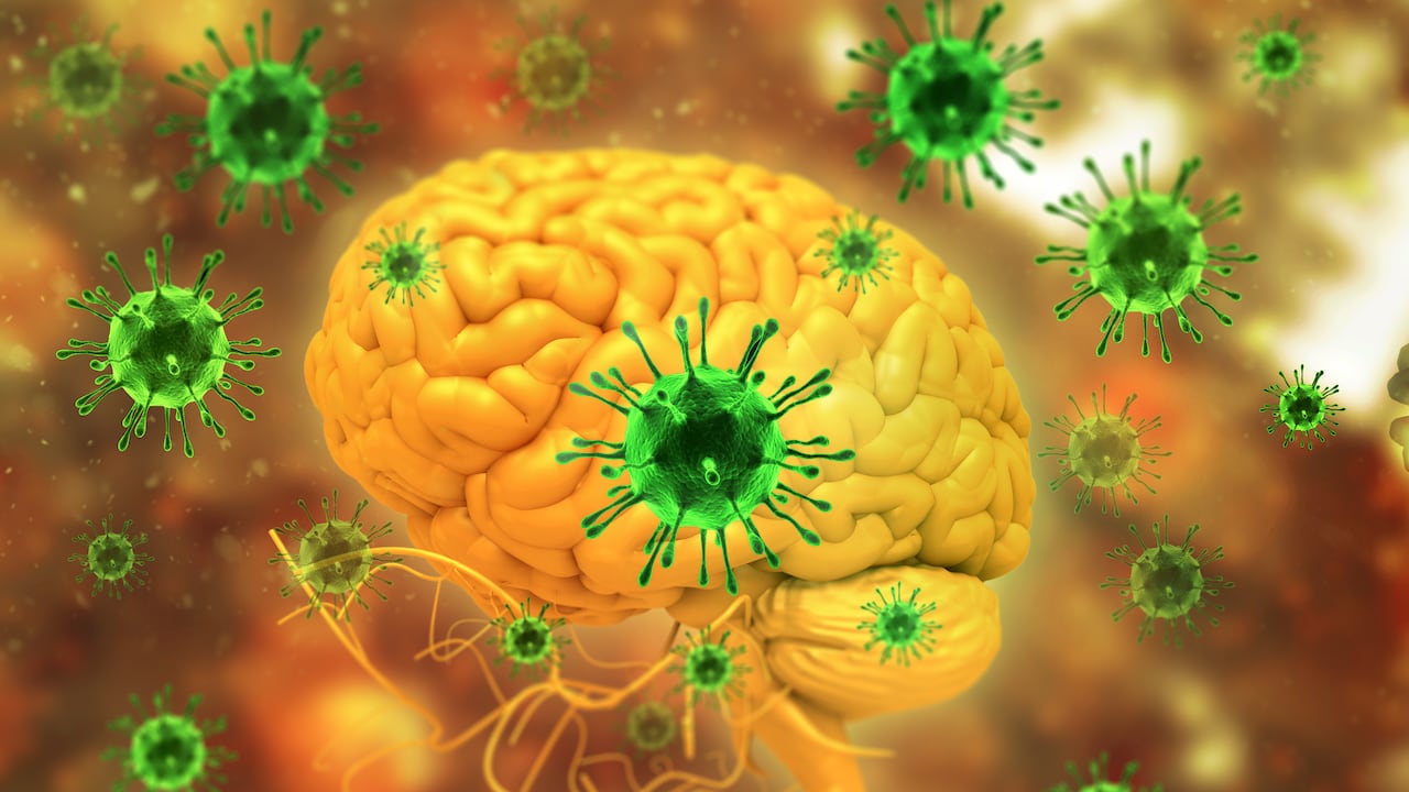 Imagen de referencia