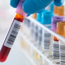 El VIH no es lo mismo que el SIDA.