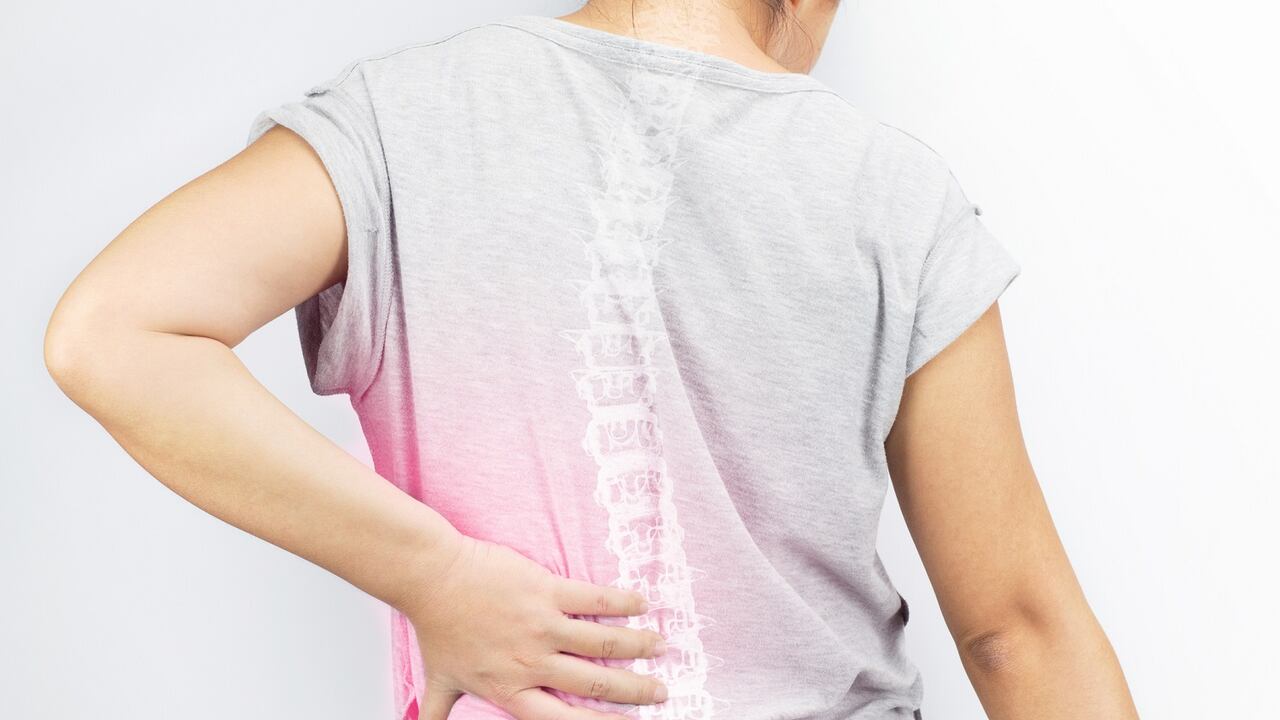 Hernia discal: cuáles con los síntomas y cómo prevenirla