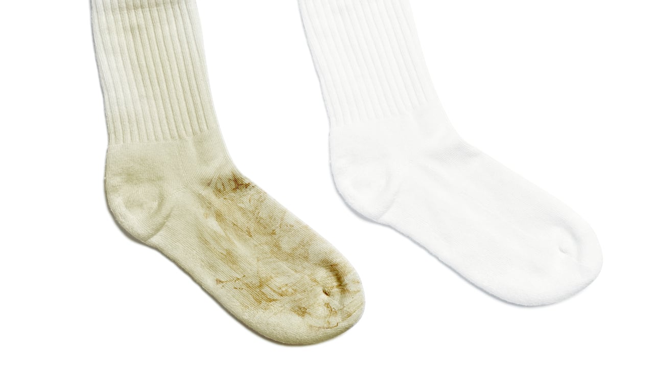 Evitar que las medias se pongan negras puede ser un desafío.