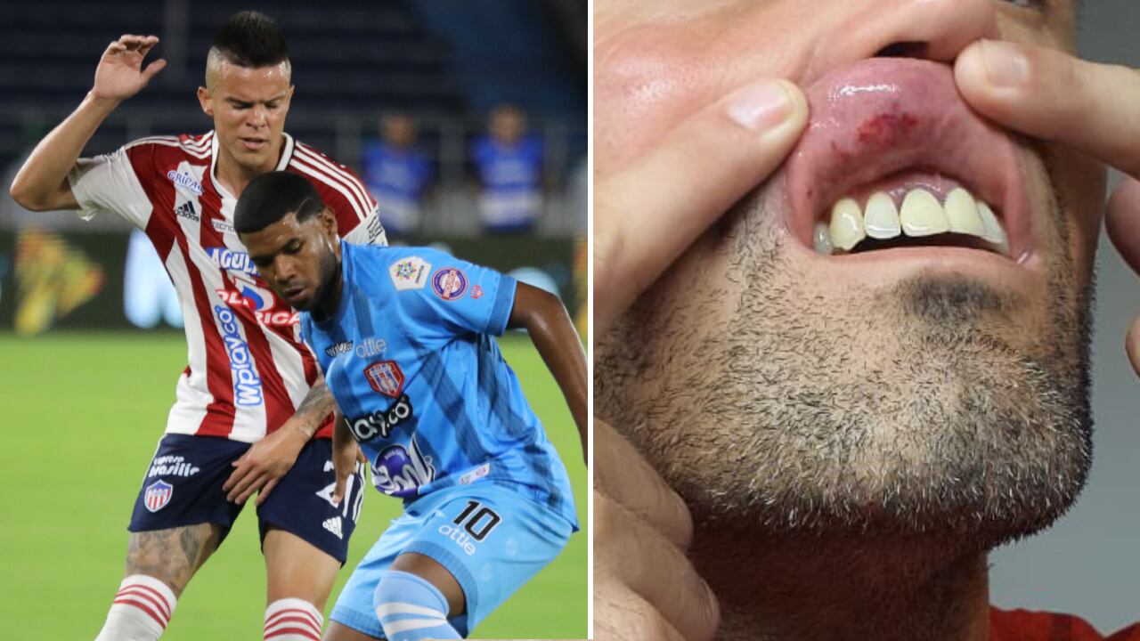 Junior ganó 7-1, pero podría caerle una dura sanción.