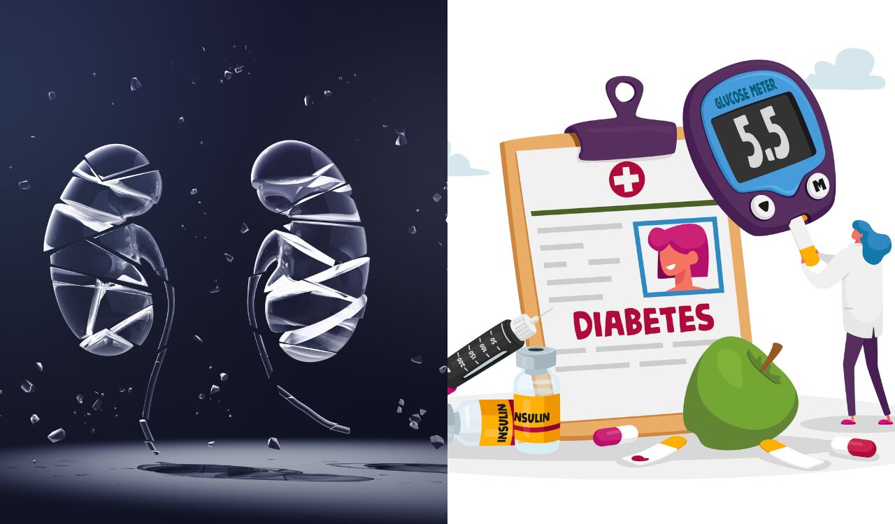 Riñón, riñones, diabetes