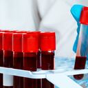 Sangre en tubos de ensayo