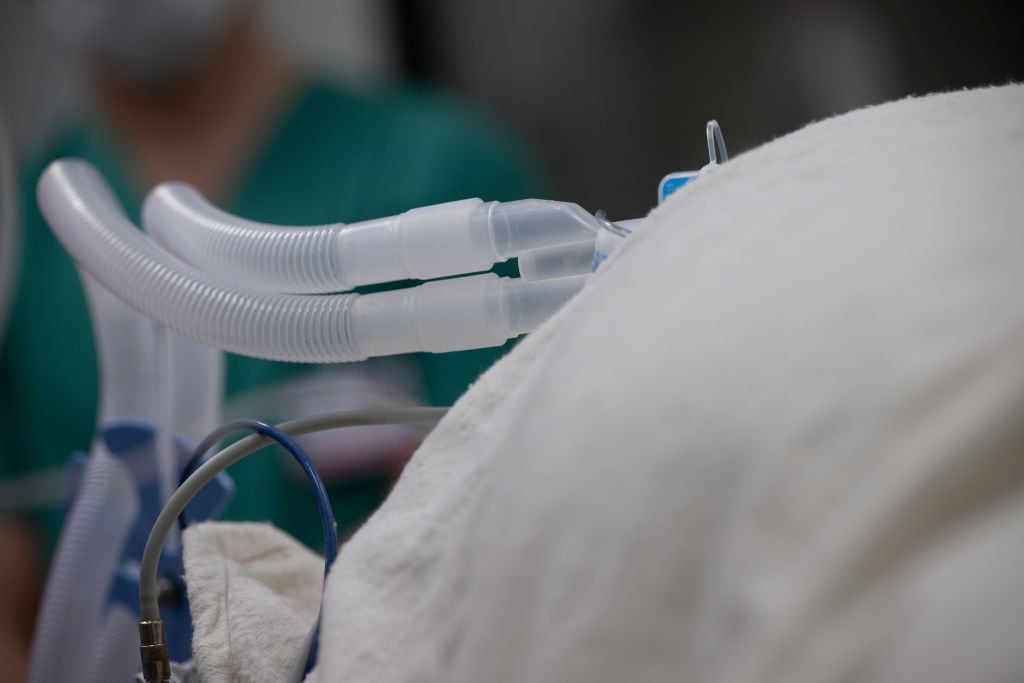 Un paciente ya anestesiado en Frankfurt yace en una habitación en preparación para la cirugía en un hospital. Foto: Sebastian Gollnow/dpa (Foto de Sebastian Gollnow/Picture Alliance vía Getty Images)