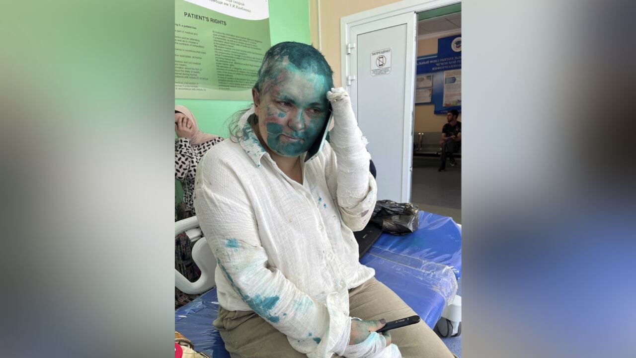 La periodista Elena Milashina, fue golpeada y rapada por militantes chechenos.