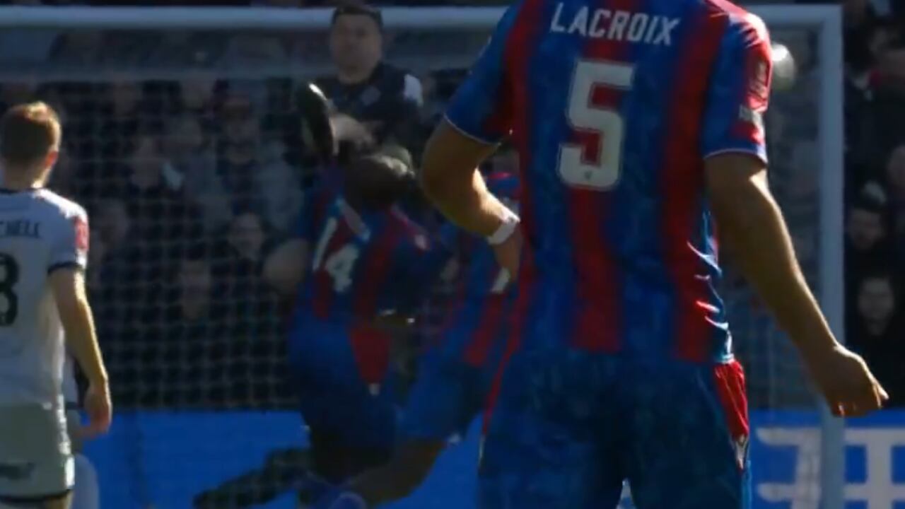 Jean-Philippe Mateta sufrió una lesión de oído tras la patada