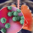 El coronavirus puede causar lesiones severas en los pulmones.