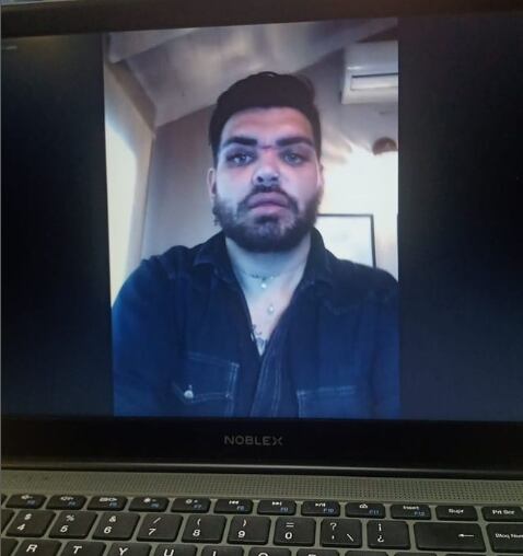 Fran Mariano dice que este punto de su vida, donde los excesos han hecho de las suyas le ha tocado elegir entre vivir o perder la belleza