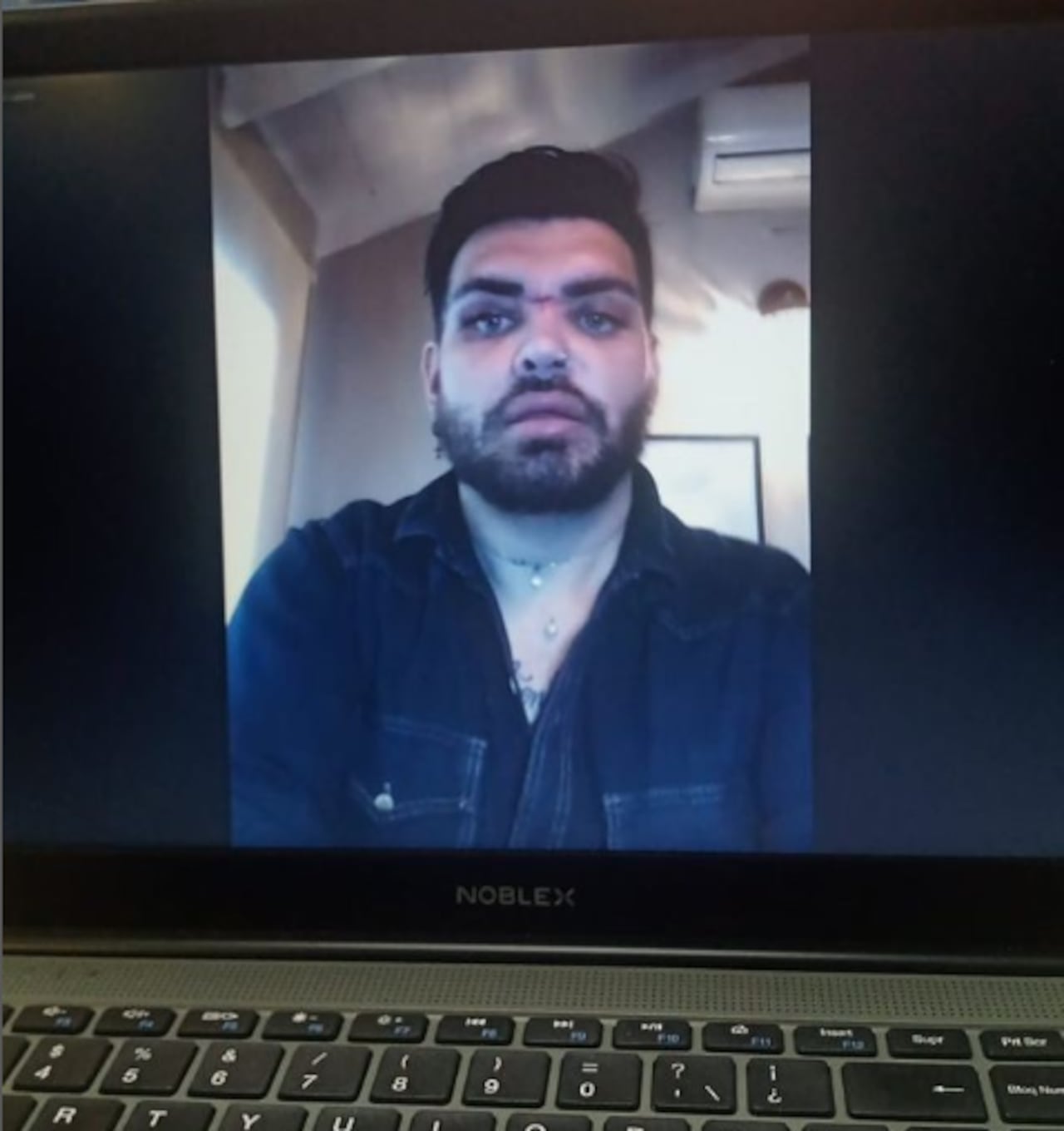 Fran Mariano dice que este punto de su vida, donde los excesos han hecho de las suyas le ha tocado elegir entre vivir o perder la belleza