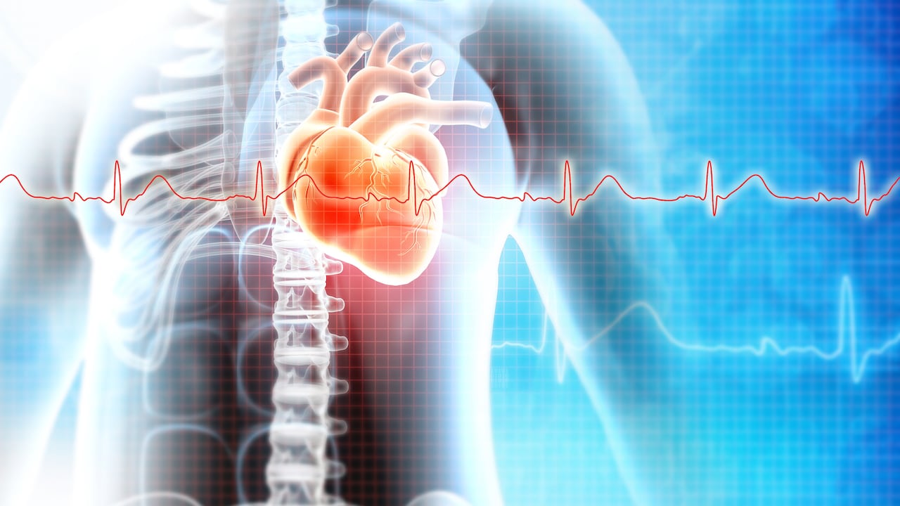 Los vasos sanguíneos se ven obstruidos por los altos niveles de glucosa,